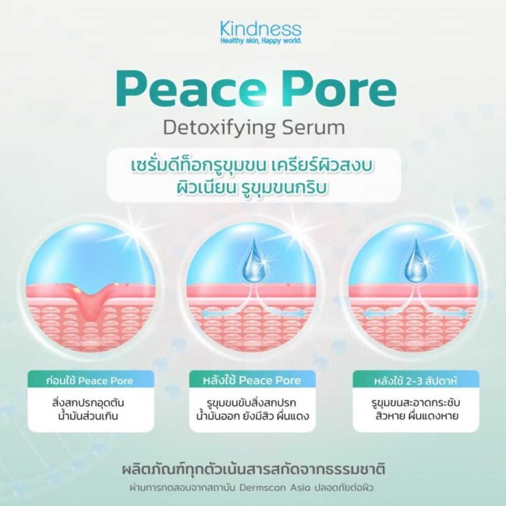 Kindness Peace Pore Detoxifying Serum 20 ml. | Watsons.co.th